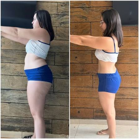Patient results before and after GLP-1 treatment