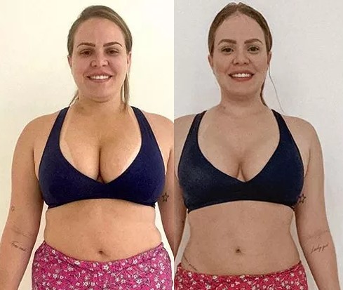 Patient results before and after GLP-1 treatment